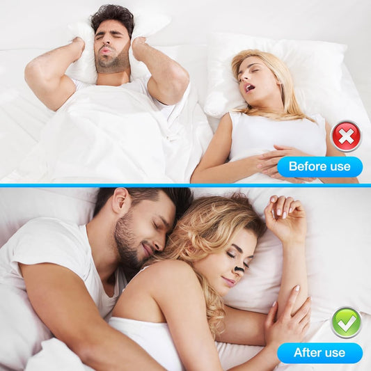 Full-Set (4 sizes nose strips + 30 Days intakes pack included)